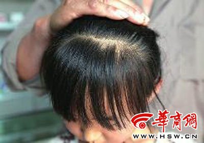 　8歲的嘟嘟在爺爺懷中顯得特別害怕，3個月前被老師揪掉的頭發(fā)至今沒有長出 本報記者 趙釗 攝