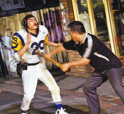 楊佑寧拍戲挨拳當(dāng)場(chǎng)吐血 下唇爆裂縫8針恐留疤