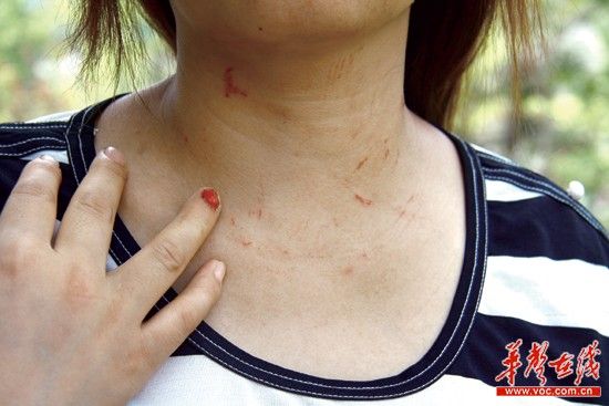 妻子現(xiàn)場(chǎng)抓住小三 竟被丈夫開(kāi)車拖行百米