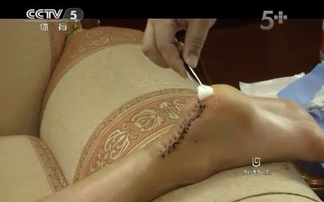 劉翔自稱經(jīng)得起歷史考驗 稱腳傷時感覺被抽了一鞭子 劉翔自稱經(jīng)得起歷史考驗 稱腳傷時感覺被抽了一鞭子