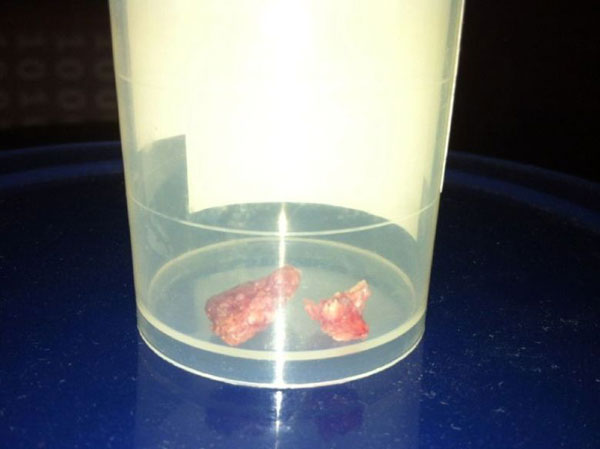 劉翔自稱經(jīng)得起歷史考驗 稱腳傷時感覺被抽了一鞭子 劉翔自稱經(jīng)得起歷史考驗 稱腳傷時感覺被抽了一鞭子